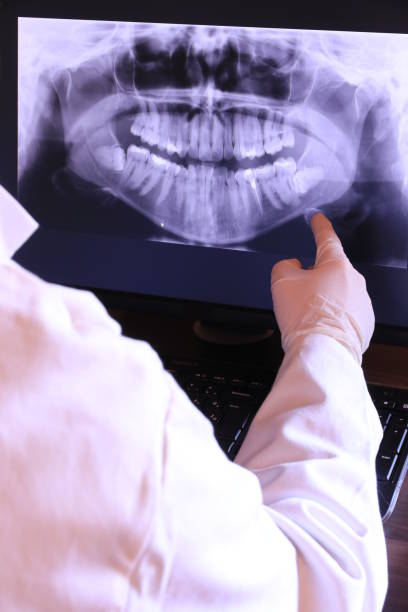 Best Emergency Root Canal Therapy in Ashland, AL